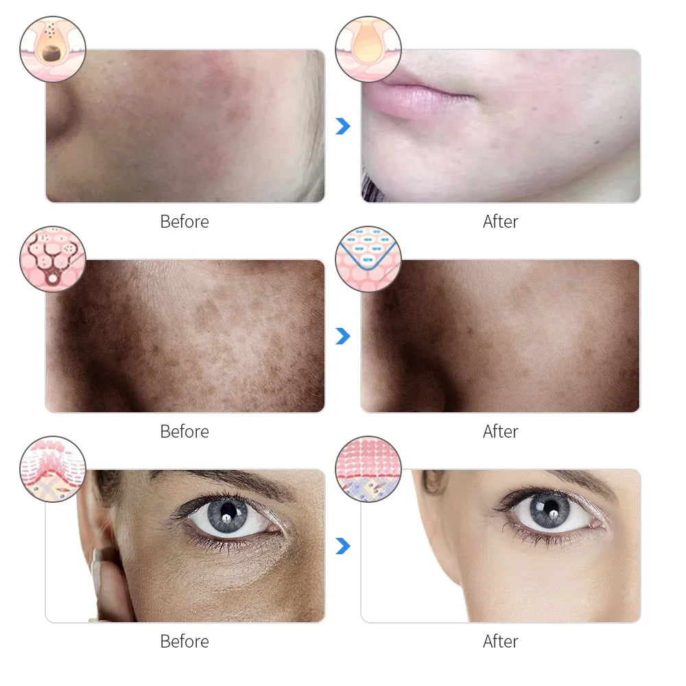 Beauty Led Light Face Mask